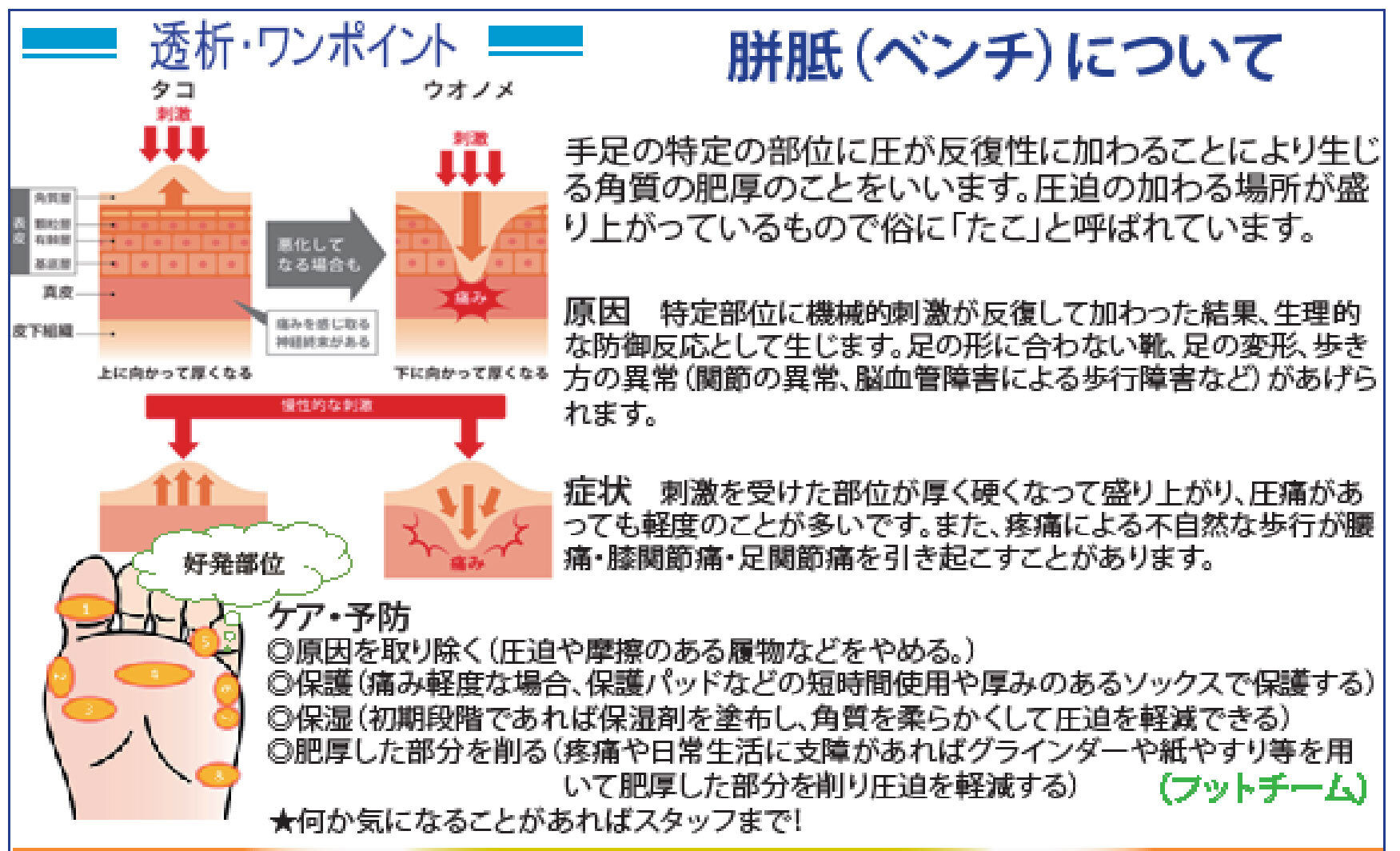 胼胝（ベンチ）について